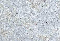 Mauerabdeckung Granit Kashmire White, flach